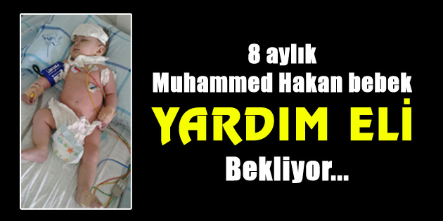 Aksaray’da 8 aylık bebek yardım eli bekliyor