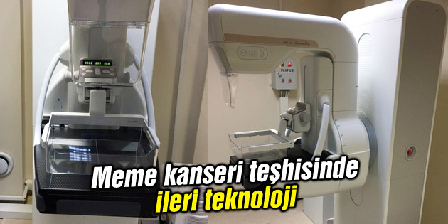 Meme kanseri teşhisinde ileri teknoloji