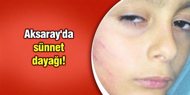 Aksaray’da sünnet dayağı