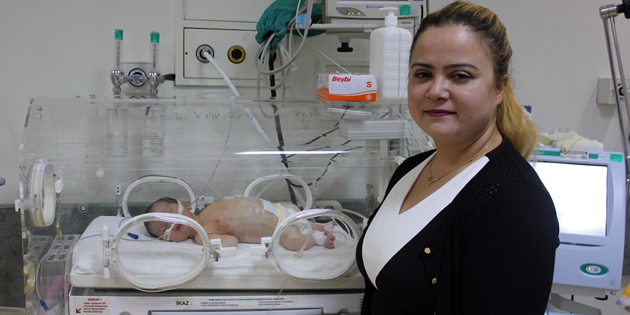 33 saatlik bebek ameliyat edildi
