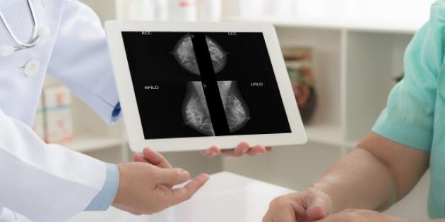 Mamografinizin sonucunun şüpheli olması ne anlama gelir?