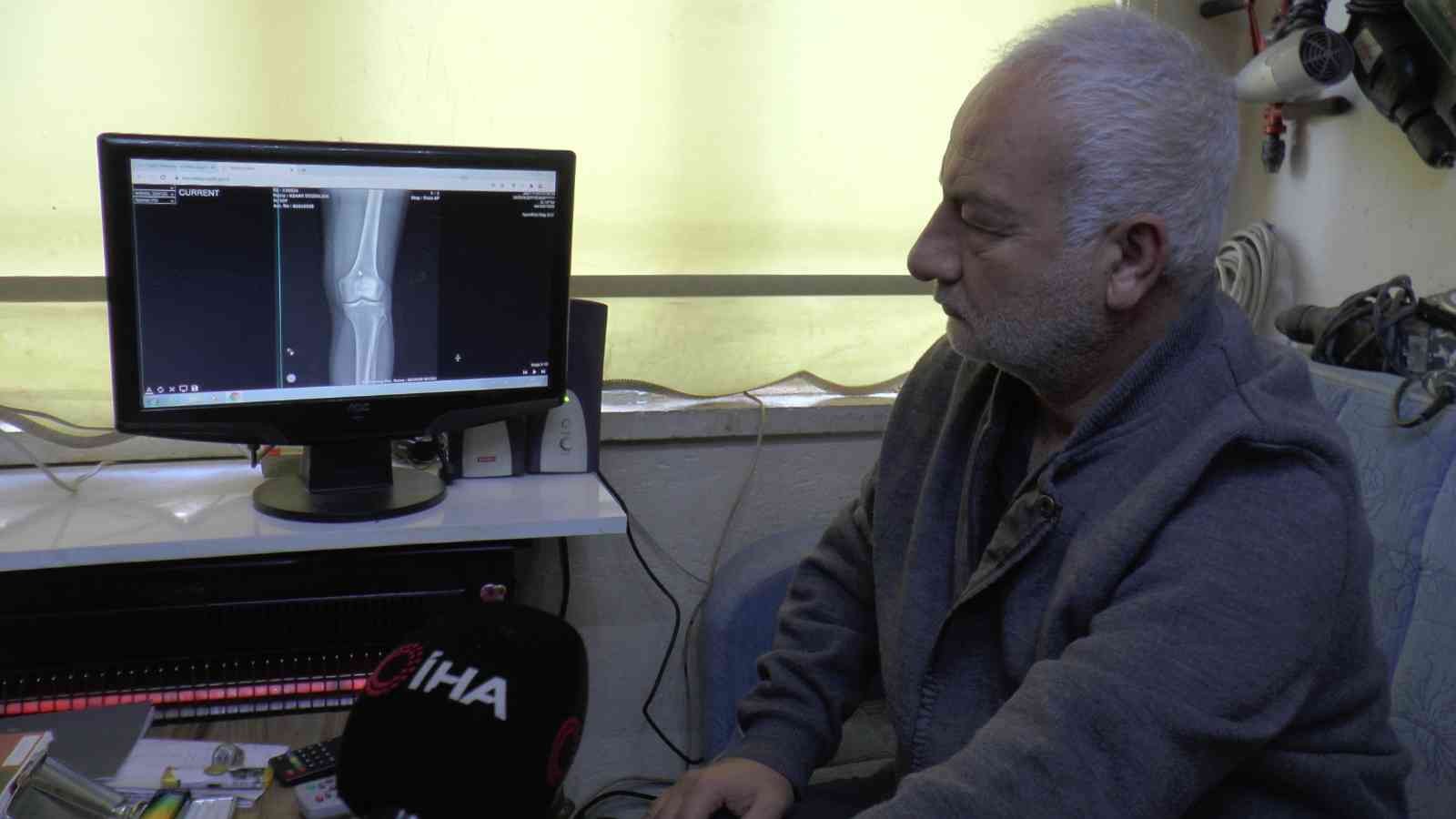 Diz kapağındaki mermi 13 gün sonra fark edildi