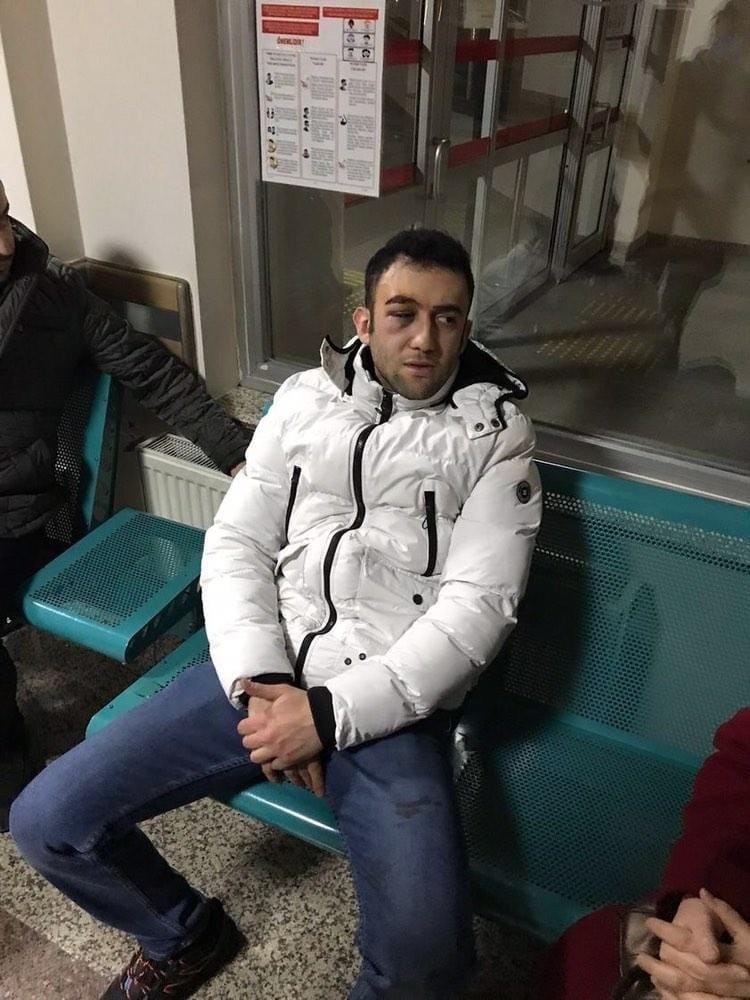 Başkent’te müşteri ile market çalışanının kavgası kamerada
