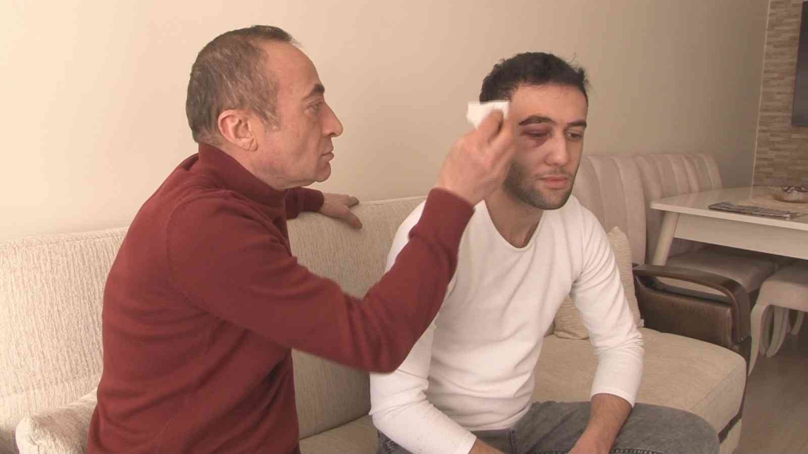 Darp edilen A101 çalışanı: “Bir şeker uğruna saldırıya uğradık”